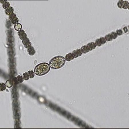 Detailaufnahme von Anabaena sp.