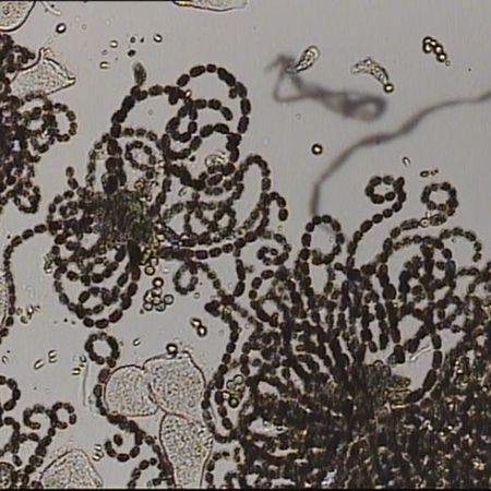 Detailaufnahme von Anabaena sp.