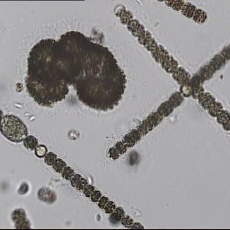 Detailaufnahme von Microcystis sp.