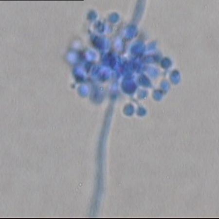 Detailaufnahme von Beauveria bassiana