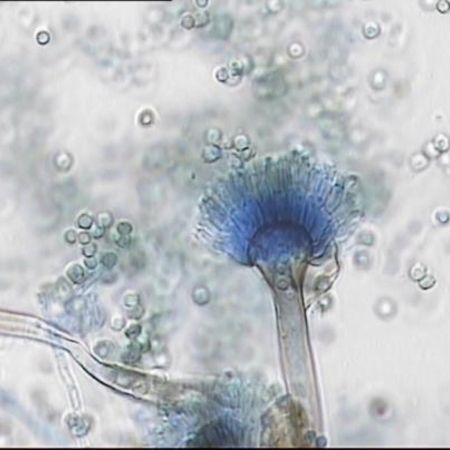 Detailaufnahme von Aspergillus nidulans