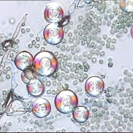 Detailaufnahme von Hüllzellen Aspergillus nidulans