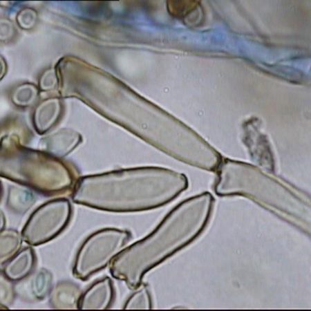 Detailaufnahme von Cladosporium cladosporioides Komplex