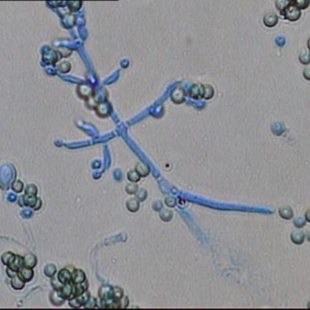 Detailaufnahme von Trichoderma viride Komplex