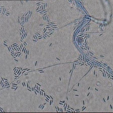 Detailaufnahme von Sarocladium strictum