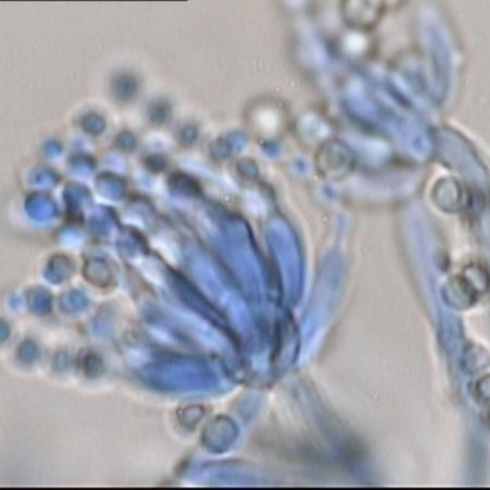 Detailaufnahme von Penicillium glabrum