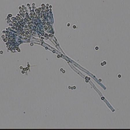 Detailaufnahme von Penicillium sp.