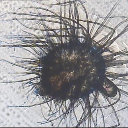 Detailaufnahme von Chaetomium elatum