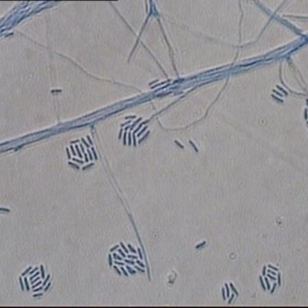 Detailaufnahme von Sarocladium kiliense